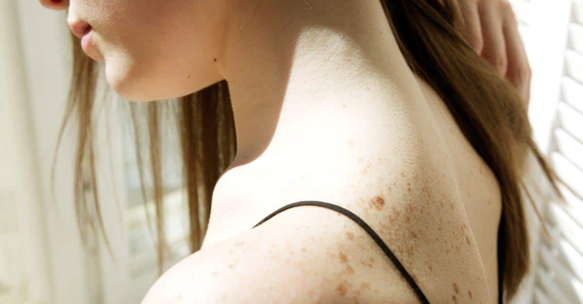 How to relieve neck and shoulder tension